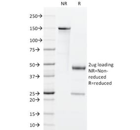 SDS-PAGE - Anti-GM-CSF Antibody [BVD2-21C11] (A248272) - Antibodies.com