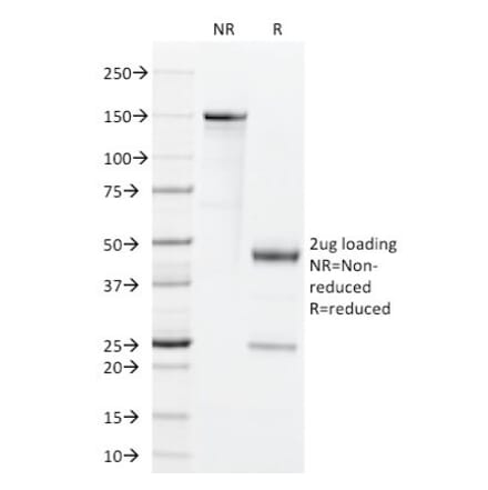 SDS-PAGE - Anti-GM-CSF Antibody [BVD2-21C11] (A248272) - Antibodies.com