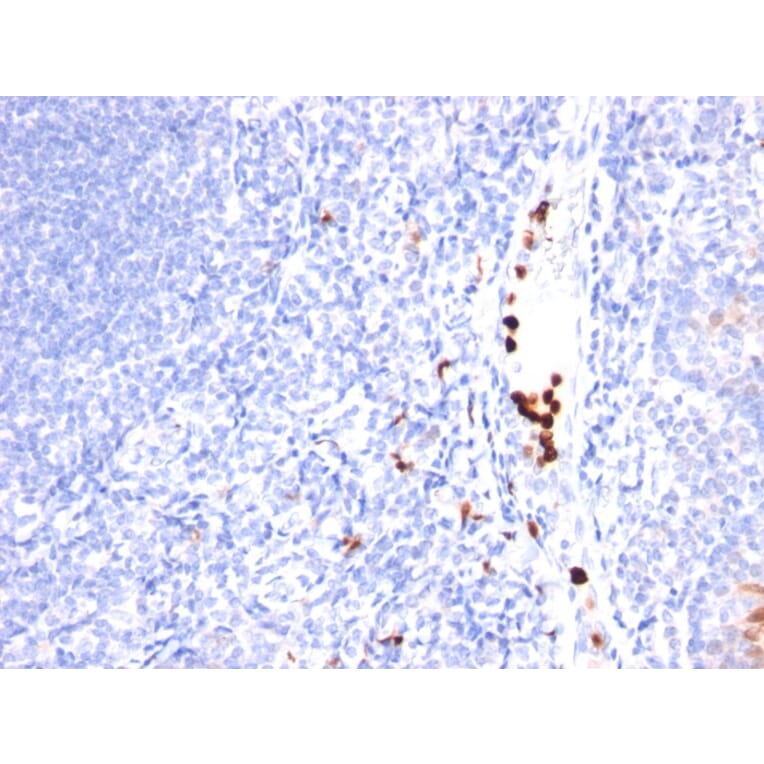 Immunohistochemistry - Anti-G-CSF Antibody [SPM468] (A248275) - Antibodies.com