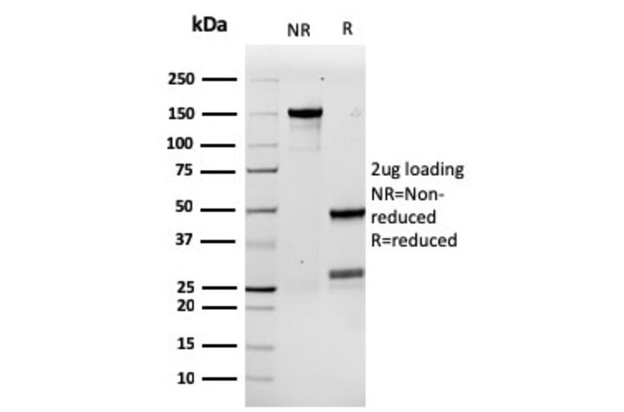SDS-PAGE - Anti-G-CSF Antibody [rCSF3/900] (A248277) - Antibodies.com