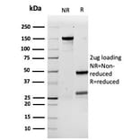 SDS-PAGE - Anti-G-CSF Antibody [rCSF3/900] (A248277) - Antibodies.com