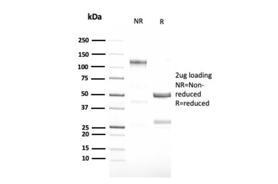 SDS-PAGE - Anti-G-CSF Antibody [CSF3/3166R] (A248278) - Antibodies.com