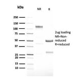 SDS-PAGE - Anti-G-CSF Antibody [CSF3/3166R] (A248278) - Antibodies.com