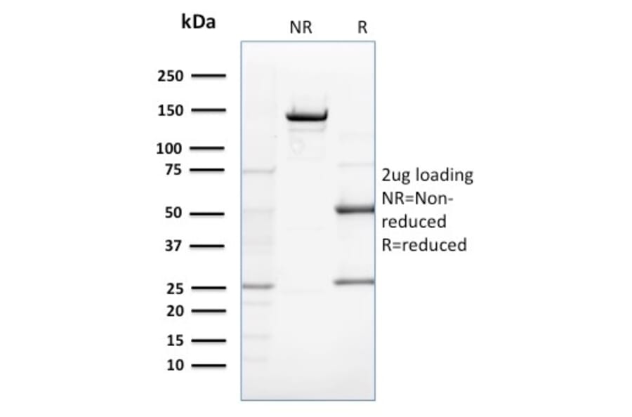 SDS-PAGE - Anti-ZNF690 Antibody [ZSCAN29/2610] (A248279) - Antibodies.com
