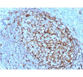 Immunohistochemistry - Anti-Cystatin A Antibody [CSTA/3553] (A248283) - Antibodies.com