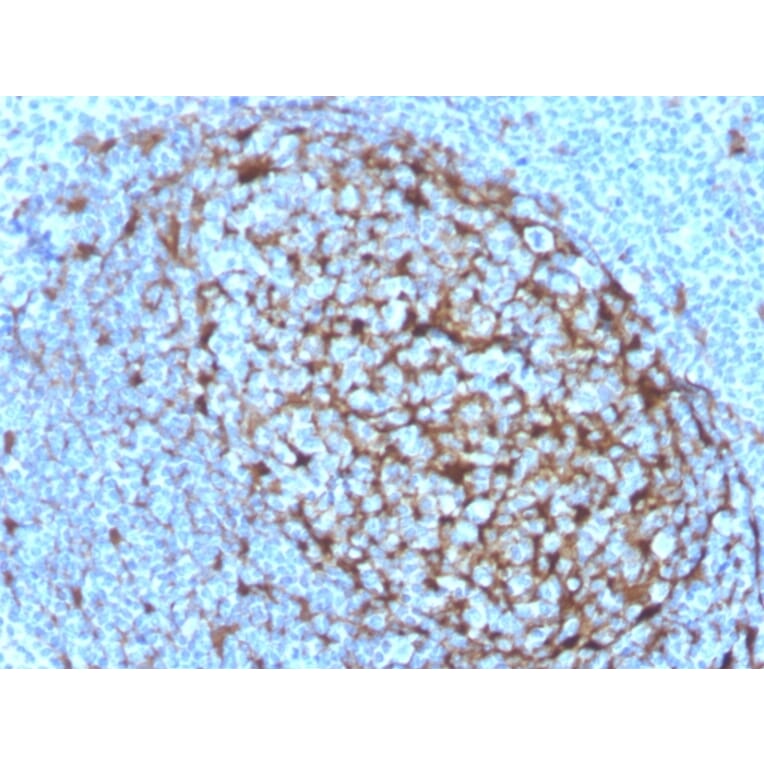 Immunohistochemistry - Anti-Cystatin A Antibody [CSTA/3553] (A248283) - Antibodies.com