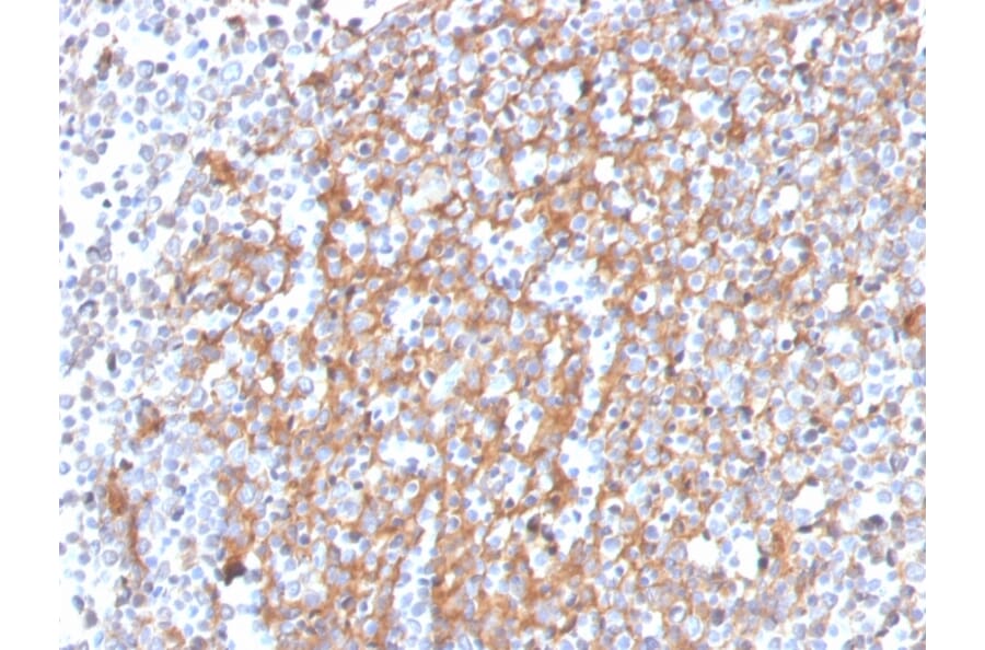 Immunohistochemistry - Anti-Cystatin A Antibody [CSTA/3553] (A248283) - Antibodies.com
