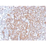 Immunohistochemistry - Anti-Cystatin A Antibody [CSTA/3553] (A248283) - Antibodies.com