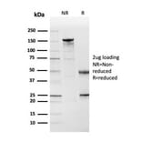 SDS-PAGE - Anti-Cystatin A Antibody [CSTA/3553] (A248283) - Antibodies.com