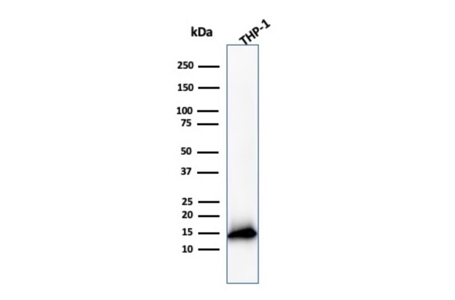 Western Blot - Anti-Cystatin A Antibody [CSTA/3553] (A248283) - Antibodies.com