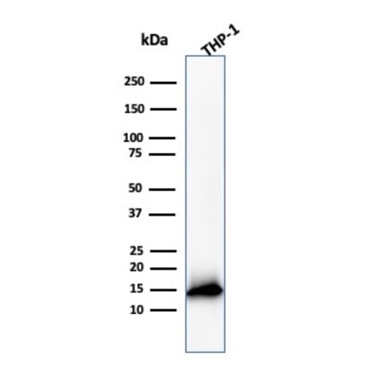 Western Blot - Anti-Cystatin A Antibody [CSTA/3553] (A248283) - Antibodies.com
