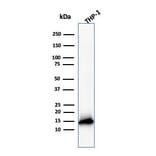 Western Blot - Anti-Cystatin A Antibody [CSTA/3553] (A248283) - Antibodies.com