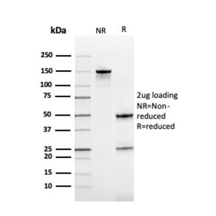 SDS-PAGE - Anti-Cystatin B Antibody [CPTC-CSTB-3] (A248284) - Antibodies.com