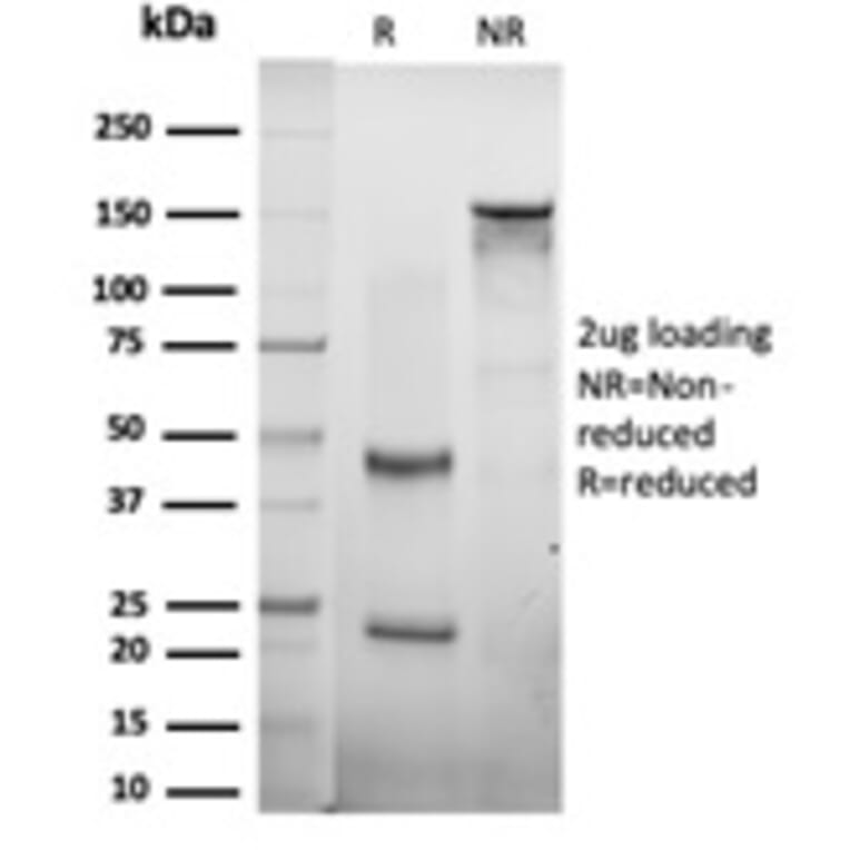 SDS-PAGE - Anti-CTBP2 Antibody [PCRP-CTBP2-1A9] (A248285) - Antibodies.com