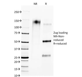 SDS-PAGE - Anti-CTLA4 Antibody [L4P2F5.F10] (A248286) - Antibodies.com