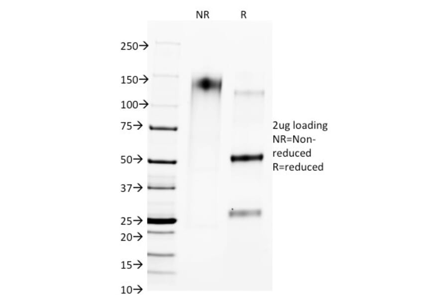 SDS-PAGE - Anti-CTLA4 Antibody [L4P2F5.F10] (A248286) - Antibodies.com