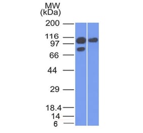 Western Blot - Anti-alpha 1 Catenin Antibody [1G5] (A248288) - Antibodies.com