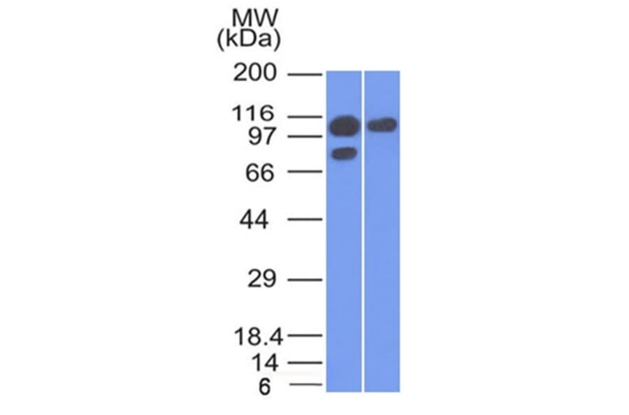 Western Blot - Anti-alpha 1 Catenin Antibody [1G5] (A248288) - Antibodies.com