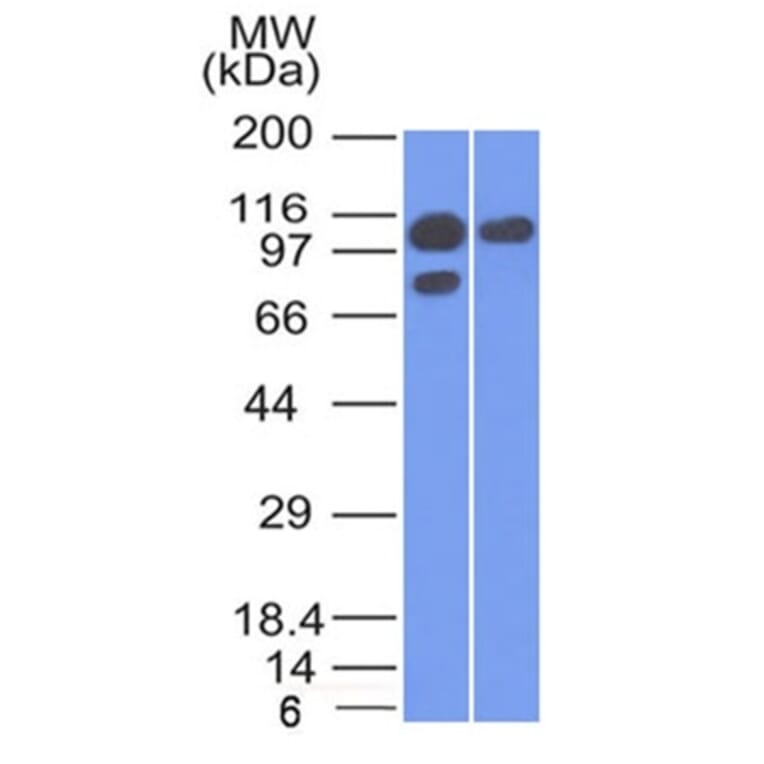 Western Blot - Anti-alpha 1 Catenin Antibody [1G5] (A248288) - Antibodies.com