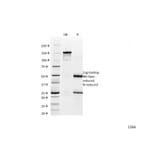 SDS-PAGE - Anti-alpha 1 Catenin Antibody [1G5] (A248287) - Antibodies.com