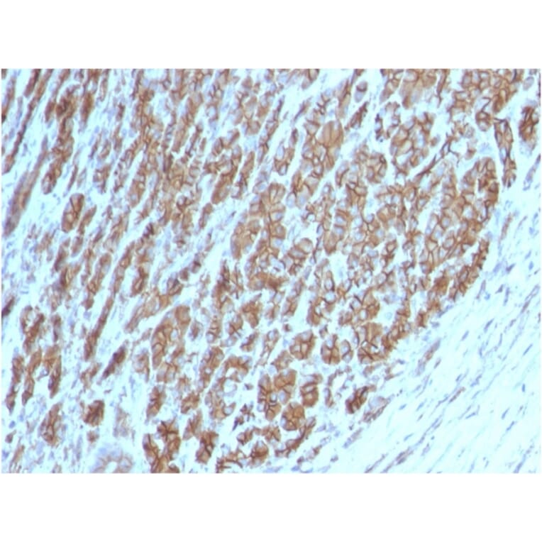 Immunohistochemistry - Anti-beta Catenin Antibody [CTNNB1/2098] (A248289) - Antibodies.com