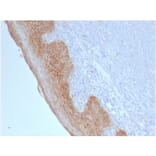 Immunohistochemistry - Anti-beta Catenin Antibody [CTNNB1/2098] (A248289) - Antibodies.com