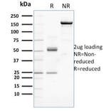 SDS-PAGE - Anti-beta Catenin Antibody [CTNNB1/2099] (A248290) - Antibodies.com