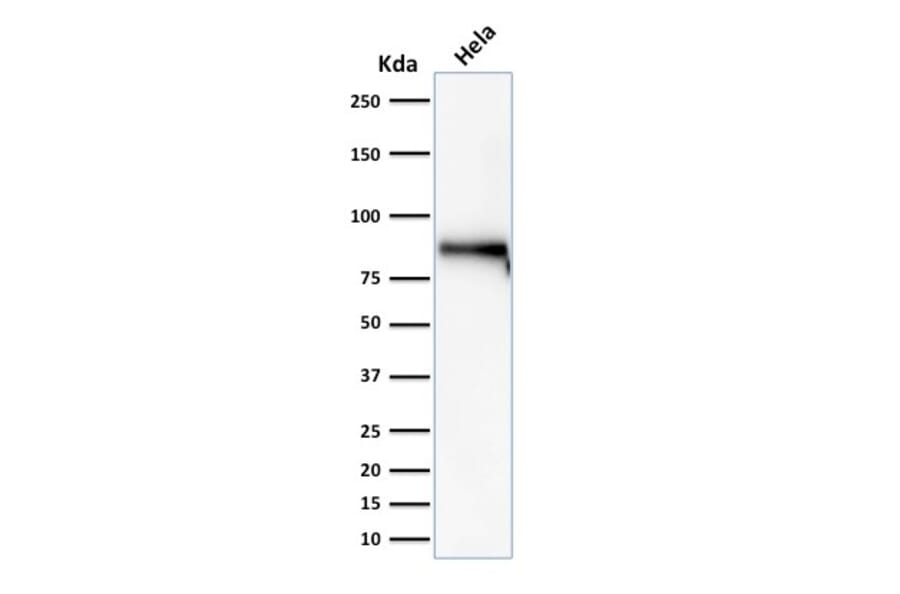 Western Blot - Anti-beta Catenin Antibody [rCTNNB1/2173] (A248291) - Antibodies.com