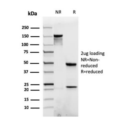 SDS-PAGE - Anti-beta Catenin Antibody [rCTNNB1/1507] (A248292) - Antibodies.com