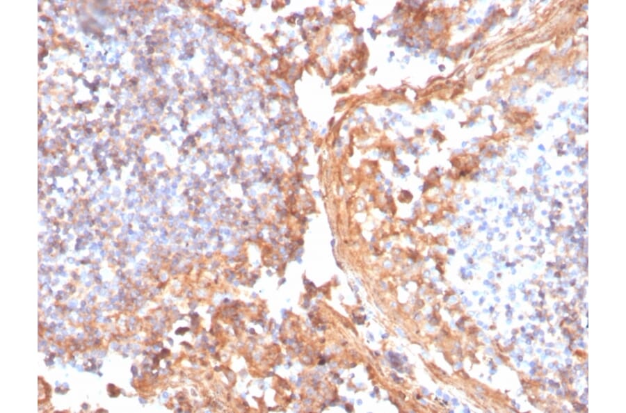 Immunohistochemistry - Anti-beta Catenin Antibody [rCTNNB1/1507] (A248292) - Antibodies.com