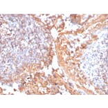 Immunohistochemistry - Anti-beta Catenin Antibody [rCTNNB1/1507] (A248292) - Antibodies.com
