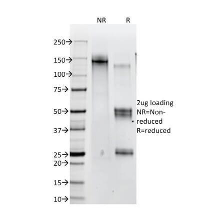 SDS-PAGE - Anti-beta Catenin Antibody [12F7] (A248292) - Antibodies.com
