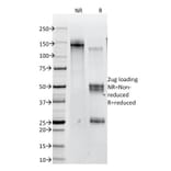 SDS-PAGE - Anti-beta Catenin Antibody [12F7] (A248292) - Antibodies.com