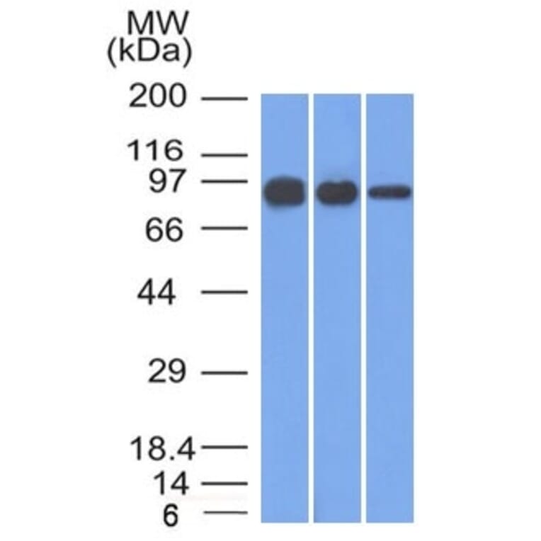 Western Blot - Anti-beta Catenin Antibody [12F7] (A248293) - Antibodies.com