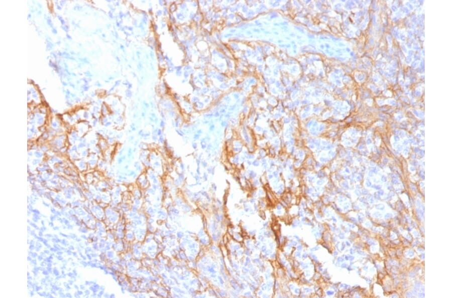 Immunohistochemistry - Anti-beta Catenin Antibody [15B8] (A248294) - Antibodies.com