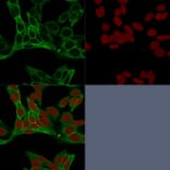 Immunofluorescence - Anti-beta Catenin Antibody [15B8] (A248293) - Antibodies.com