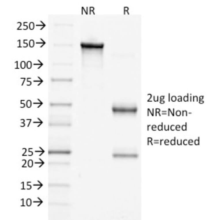 SDS-PAGE - Anti-beta Catenin Antibody [15B8] (A248294) - Antibodies.com