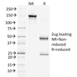 SDS-PAGE - Anti-beta Catenin Antibody [15B8] (A248294) - Antibodies.com
