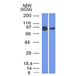 Western Blot - Anti-beta Catenin Antibody [5H10] (A248295) - Antibodies.com
