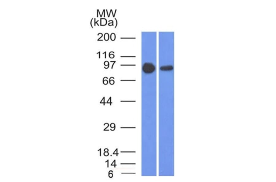 Western Blot - Anti-beta Catenin Antibody [5H10] (A248295) - Antibodies.com
