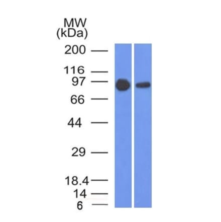 Western Blot - Anti-beta Catenin Antibody [5H10] (A248295) - Antibodies.com
