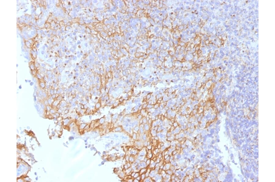 Immunohistochemistry - Anti-beta Catenin Antibody [5H10] (A248295) - Antibodies.com