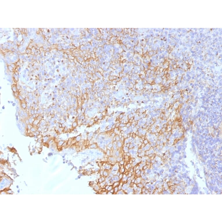 Immunohistochemistry - Anti-beta Catenin Antibody [5H10] (A248295) - Antibodies.com