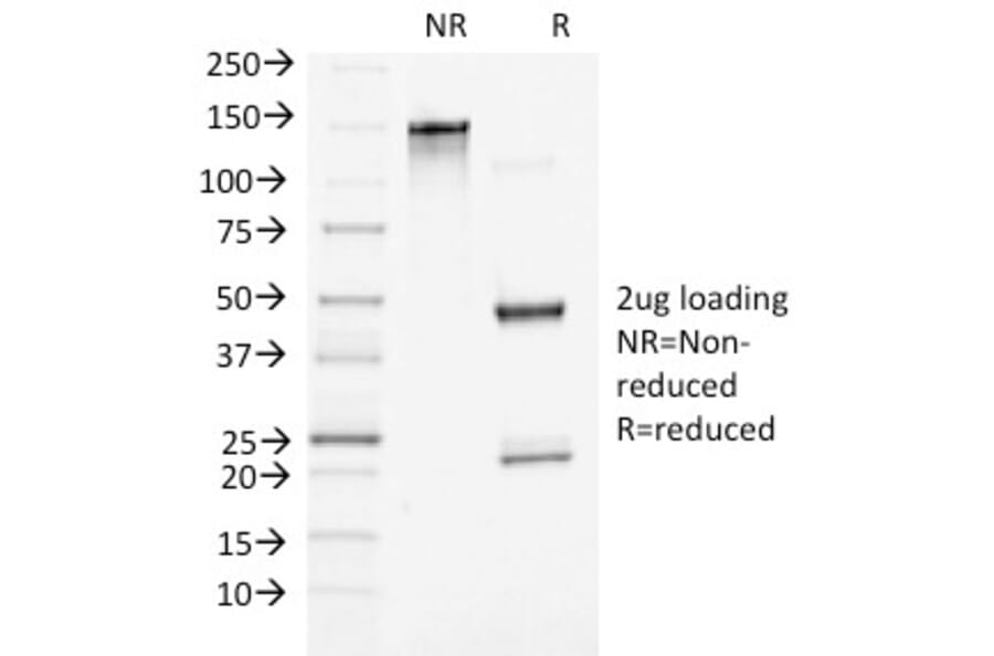 SDS-PAGE - Anti-beta Catenin Antibody [5H10] (A248295) - Antibodies.com