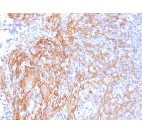 Immunohistochemistry - Anti-beta Catenin Antibody [6F9] (A248296) - Antibodies.com