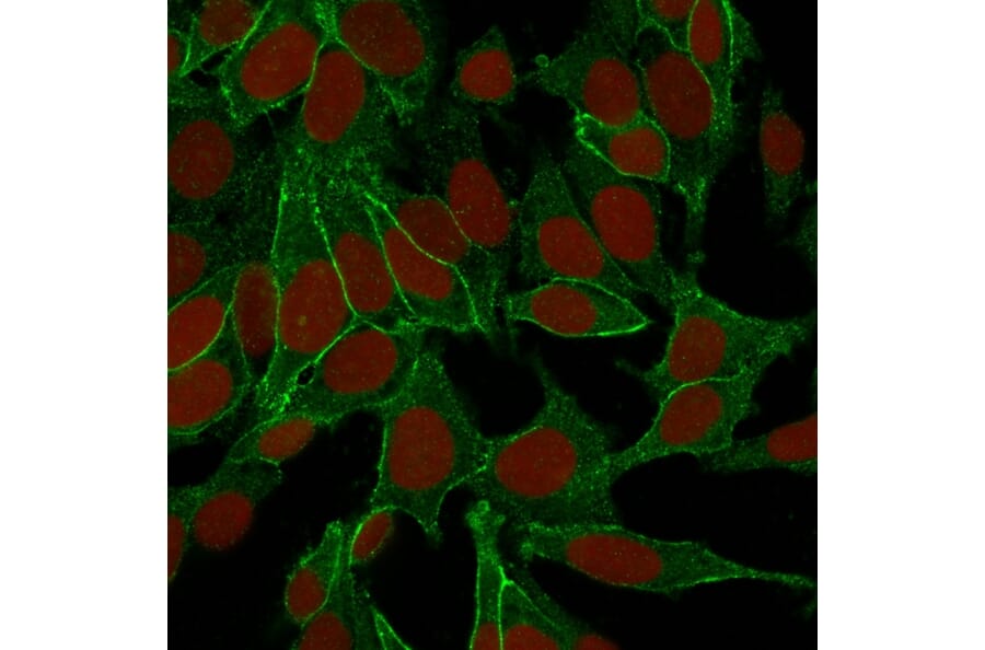 Immunofluorescence - Anti-beta Catenin Antibody [6F9] (A248295) - Antibodies.com