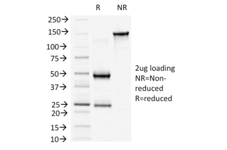SDS-PAGE - Anti-beta Catenin Antibody [6F9] (A248296) - Antibodies.com