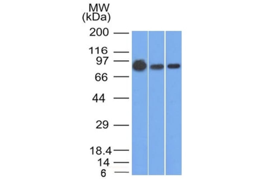 Western Blot - Anti-beta Catenin Antibody [9F2] (A248297) - Antibodies.com