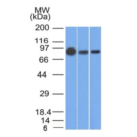 Western Blot - Anti-beta Catenin Antibody [9F2] (A248297) - Antibodies.com