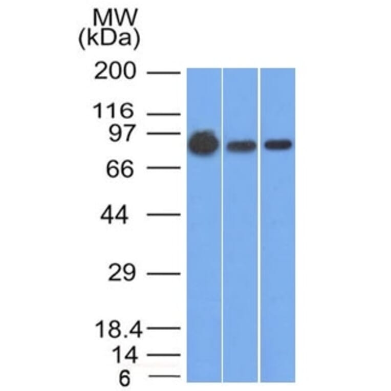 Western Blot - Anti-beta Catenin Antibody [9F2] (A248297) - Antibodies.com